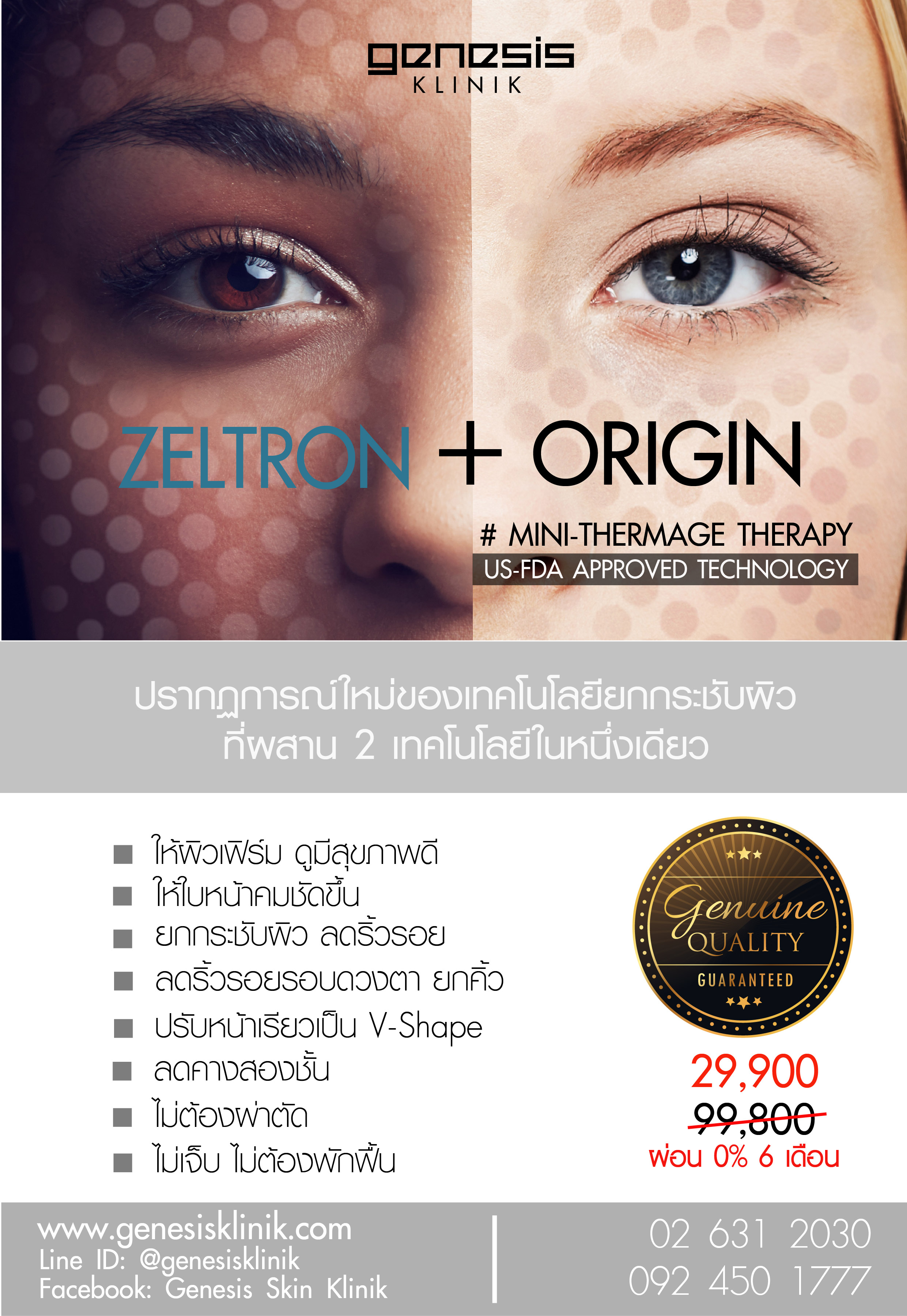 ORIGIN Mini-Thermage 
