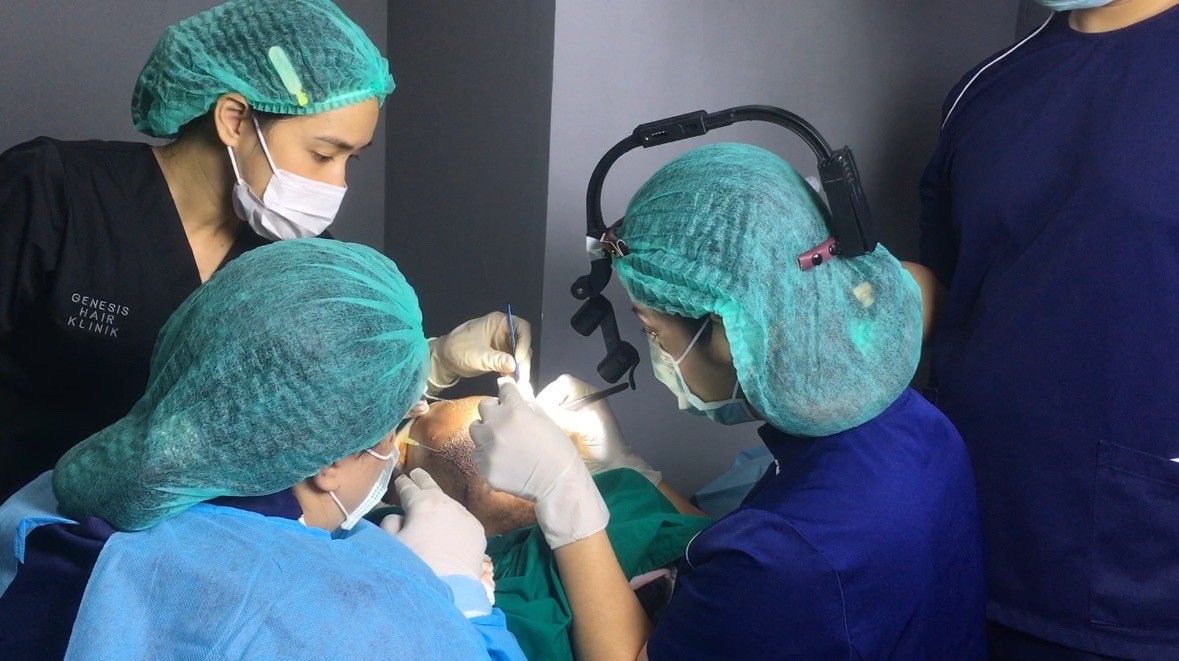 ศัลยกรรมปลูกผม HAIR TRANSPLANT